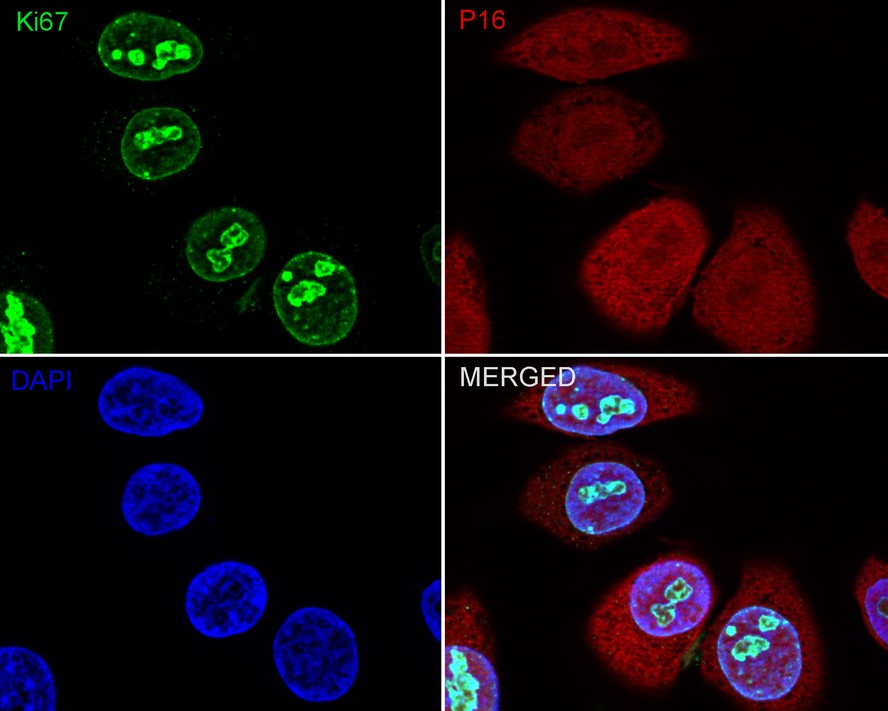 Immunocytochemistry analysis of HeLa cells labeling Ki67 with Rabbit anti-Ki67 antibody (<a href="/products/HA721115" style="font-weight: bold;text-decoration: underline;">HA721115</a>) at 1/100 dilution.<br /><br />Cells were fixed in 100% precooled methanol for 5 minutes at room temperature, then blocked with 1% BSA in 10% negative goat serum for 1 hour at room temperature. Cells were then incubated with Rabbit anti-Ki67 antibody (<a href="/products/HA721115" style="font-weight: bold;text-decoration: underline;">HA721115</a>) at 1/100 dilution in 1% BSA in PBST overnight at 4 ℃. Goat Anti-Rabbit IgG H&L (iFluor™ 488, <a href="/products/HA1121" style="font-weight: bold;text-decoration: underline;">HA1121</a>) was used as the secondary antibody at 1/1,000 dilution. PBS instead of the primary antibody was used as the secondary antibody only control. Nuclear DNA was labelled in blue with DAPI.<br /><br />Beta tubulin (<a href="/products/M1305-2" style="font-weight: bold;text-decoration: underline;">M1305-2</a>, red) was stained at 1/100 dilution overnight at +4℃. Goat Anti-Mouse IgG H&L (iFluor™ 594, <a href="/products/HA1126" style="font-weight: bold;text-decoration: underline;">HA1126</a>) was used as the secondary antibody at 1/1,000 dilution.
