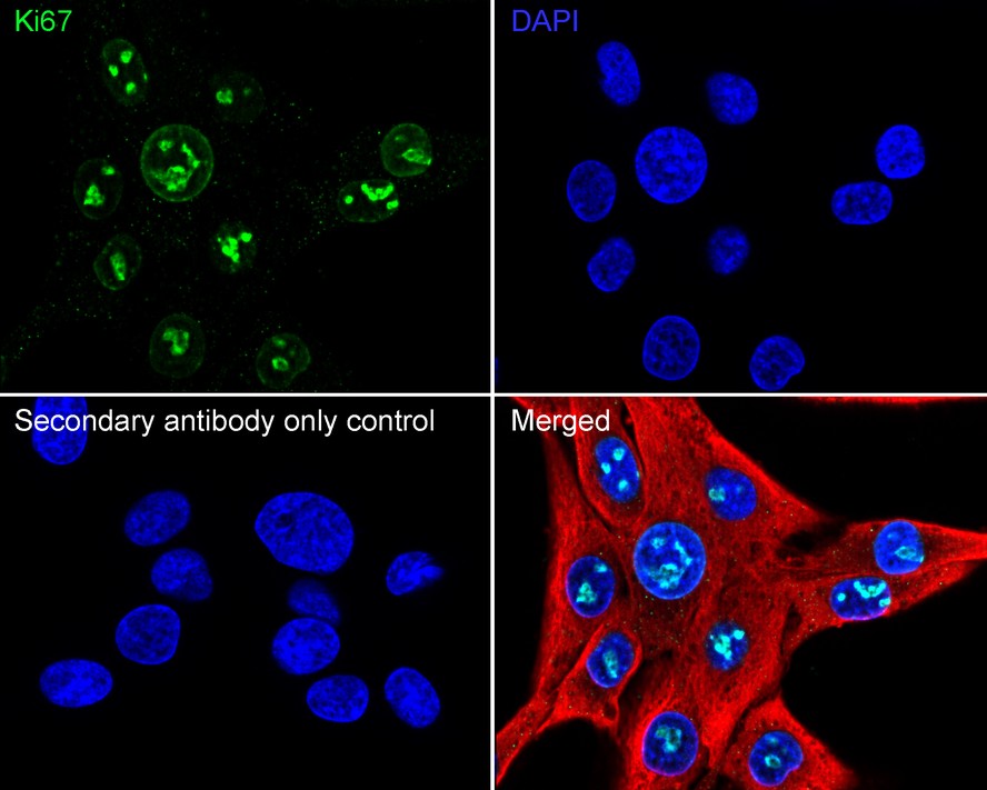 Immunocytochemistry analysis of HeLa cells labeling Ki67 with Rabbit anti-Ki67 antibody (<a href="/products/HA721115" style="font-weight: bold;text-decoration: underline;">HA721115</a>) at 1/250 dilution.<br /><br />Cells were fixed in 4% paraformaldehyde for 20 minutes at room temperature, permeabilized with 0.1% Triton X-100 in PBS for 5 minutes at room temperature, then blocked with 1% BSA in 10% negative goat serum for 1 hour at room temperature. Cells were then incubated with Rabbit anti-Ki67 antibody (<a href="/products/HA721115" style="font-weight: bold;text-decoration: underline;">HA721115</a>) at 1/250 dilution in 1% BSA in PBST overnight at 4 ℃. Goat Anti-Rabbit IgG H&L (iFluor™ 488, <a href="/products/HA1121" style="font-weight: bold;text-decoration: underline;">HA1121</a>) was used as the secondary antibody at 1/1,000 dilution. PBS instead of the primary antibody was used as the secondary antibody only control. Nuclear DNA was labelled in blue with DAPI.<br /><br />p16 (<a href="/products/HA601131" style="font-weight: bold;text-decoration: underline;">HA601131</a>, red) was stained at 1/100 dilution overnight at +4℃. Goat Anti-Mouse IgG H&L (iFluor™ 594, <a href="/products/HA1126" style="font-weight: bold;text-decoration: underline;">HA1126</a>) was used as the secondary antibody at 1/1,000 dilution.