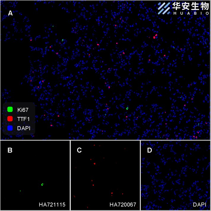 Flow cytometric analysis of HeLa cells labeling Ki67.<br /><br />Cells were fixed and permeabilized. Then stained with the primary antibody (<a href="/products/HA721115" style="font-weight: bold;text-decoration: underline;">HA721115</a>, 1μg/mL) (red) compared with Rabbit IgG Isotype Control (green). After incubation of the primary antibody at +4℃ for an hour, the cells were stained with a iFluor™ 488 conjugate-Goat anti-Rabbit IgG Secondary antibody (<a href="/products/HA1121" style="font-weight: bold;text-decoration: underline;">HA1121</a>) at 1/1,000 dilution for 30 minutes at +4℃. Unlabelled sample was used as a control (cells without incubation with primary antibody; black).