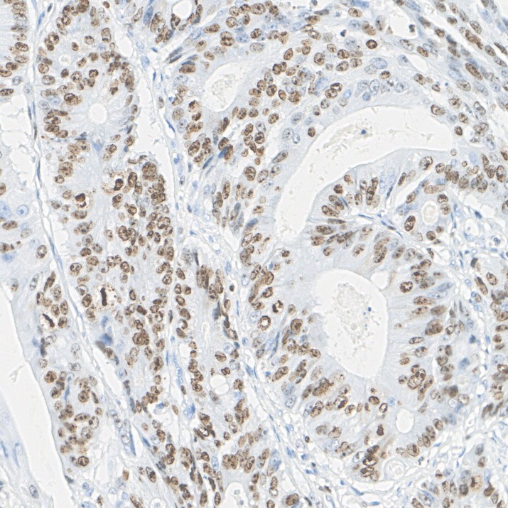 Fluorescence multiplex immunohistochemical analysis of mouse lung (Formalin/PFA-fixed paraffin-embedded sections). Panel A: the merged image of anti-Ki67 (<a href="/products/HA721115" style="font-weight: bold;text-decoration: underline;">HA721115</a>, Green) and anti-TTF1 (<a href="/products/HA720067" style="font-weight: bold;text-decoration: underline;">HA720067</a>, Red) on lung. HRP Conjugated UltraPolymer Goat Polyclonal Antibody HA1119/HA1120 was used as a secondary antibody. The immunostaining was performed with the Sequential Immuno-staining Kit (IRISKit™MH010101, www.luminiris.cn). The section was incubated in two rounds of staining: in the order of <a href="/products/HA721115" style="font-weight: bold;text-decoration: underline;">HA721115</a> (1/3,000 dilution) and <a href="/products/HA720067" style="font-weight: bold;text-decoration: underline;">HA720067</a> (1/4,000 dilution) for 20 mins at room temperature. Each round was followed by a separate fluorescent tyramide signal amplification system. Heat mediated antigen retrieval with Tris-EDTA buffer (pH 9.0) for 30 mins at 95℃. DAPI (blue) was used as a nuclear counter stain. Image acquisition was performed with Zeiss Observer 7 Inverted Fluorescence Microscope.