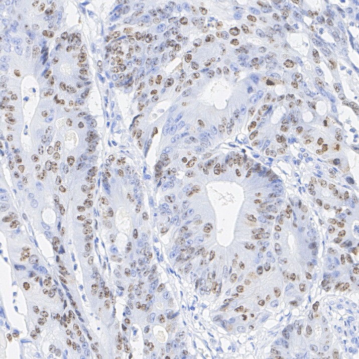 Fluorescence multiplex immunohistochemical analysis of mouse spleen (Formalin/PFA-fixed paraffin-embedded sections). Panel A: the merged image of anti-PD-L1 (<a href="/products/HA722184" style="font-weight: bold;text-decoration: underline;">HA722184</a>, Green) and anti-Ki67 (<a href="/products/HA721115" style="font-weight: bold;text-decoration: underline;">HA721115</a>, Violet) on spleen. HRP Conjugated UltraPolymer Goat Polyclonal Antibody HA1119/HA1120 was used as a secondary antibody. The immunostaining was performed with the Sequential Immuno-staining Kit (IRISKit™MH010101, www.luminiris.cn). The section was incubated in two rounds of staining: in the order of <a href="/products/HA722184" style="font-weight: bold;text-decoration: underline;">HA722184</a> (1/500 dilution) and <a href="/products/HA721115" style="font-weight: bold;text-decoration: underline;">HA721115</a> (1/2,000 dilution) for 20 mins at room temperature. Each round was followed by a separate fluorescent tyramide signal amplification system. Heat mediated antigen retrieval with Tris-EDTA buffer (pH 9.0) for 30 mins at 95℃. DAPI (blue) was used as a nuclear counter stain. Image acquisition was performed with Olympus VS200 Slide Scanner.