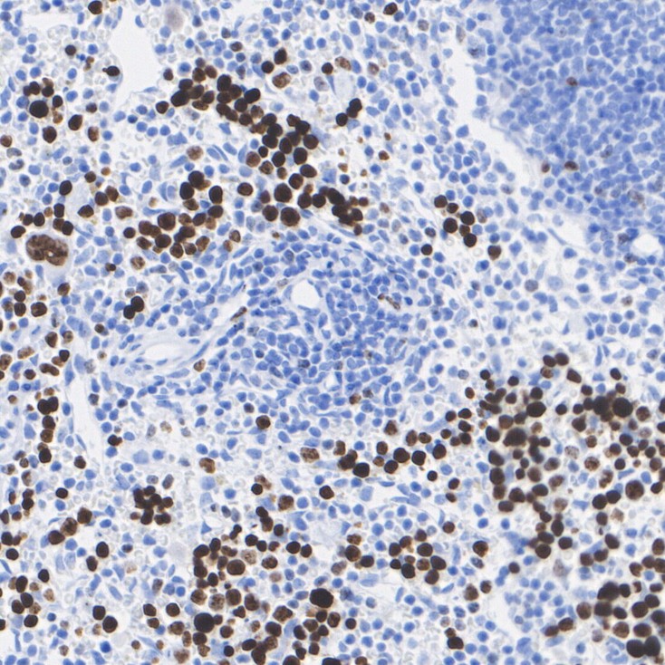 Immunohistochemical analysis of paraffin-embedded mouse spleen tissue with Rabbit anti-Ki67 antibody (<a href="/products/HA721115" style="font-weight: bold;text-decoration: underline;">HA721115</a>) at 1/15,000 dilution.<br /><br />The section was pre-treated using heat mediated antigen retrieval with sodium citrate buffer (pH 6.0) for 2 minutes. The tissues were blocked in 1% BSA for 20 minutes at room temperature, washed with ddH<sub>2</sub>O and PBS, and then probed with the primary antibody (<a href="/products/HA721115" style="font-weight: bold;text-decoration: underline;">HA721115</a>) at 1/15,000 dilution for 1 hour at room temperature. The detection was performed using an HRP conjugated compact polymer system. DAB was used as the chromogen. Tissues were counterstained with hematoxylin and mounted with DPX.
