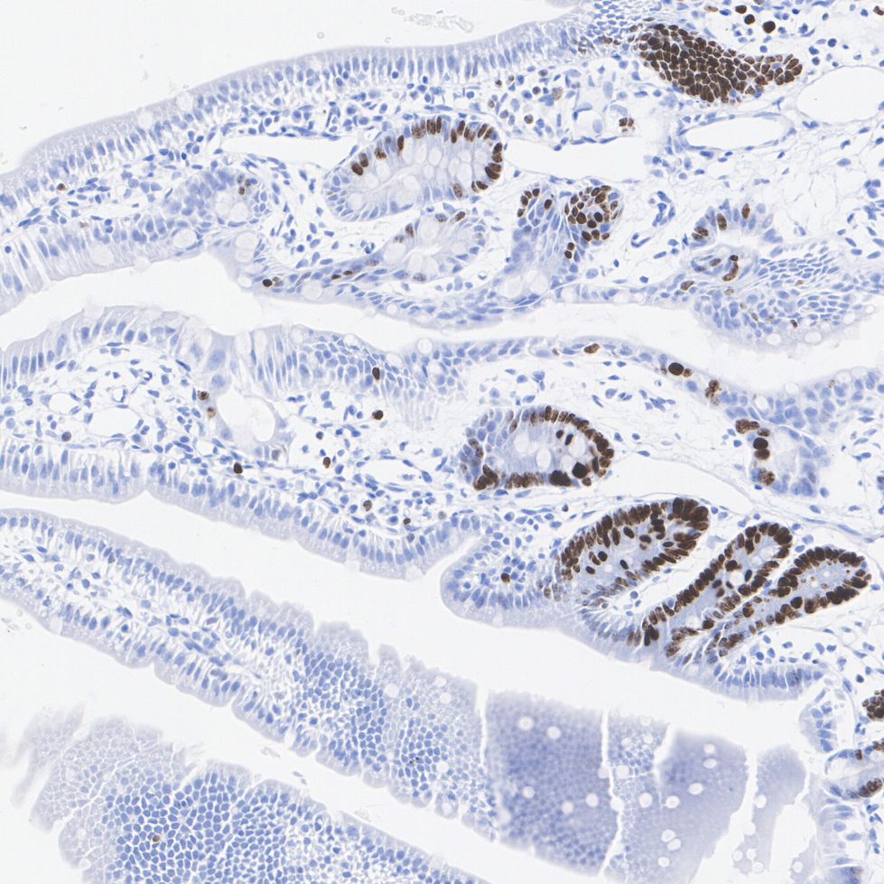 Immunohistochemical analysis of paraffin-embedded mouse small intestine tissue with Rabbit anti-Ki67 antibody (<a href="/products/HA721115" style="font-weight: bold;text-decoration: underline;">HA721115</a>) at 1/15,000 dilution.<br /><br />The section was pre-treated using heat mediated antigen retrieval with sodium citrate buffer (pH 6.0) for 2 minutes. The tissues were blocked in 1% BSA for 20 minutes at room temperature, washed with ddH<sub>2</sub>O and PBS, and then probed with the primary antibody (<a href="/products/HA721115" style="font-weight: bold;text-decoration: underline;">HA721115</a>) at 1/15,000 dilution for 1 hour at room temperature. The detection was performed using an HRP conjugated compact polymer system. DAB was used as the chromogen. Tissues were counterstained with hematoxylin and mounted with DPX.