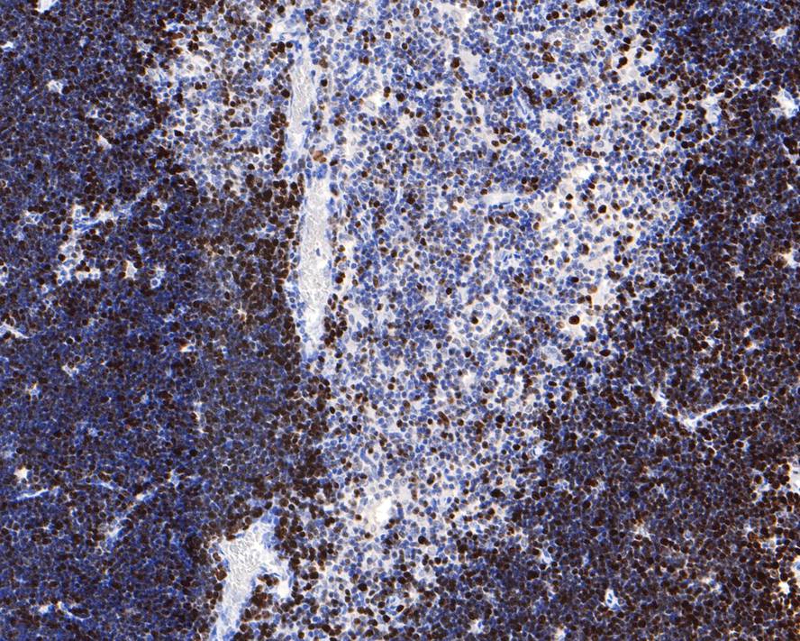 Immunohistochemical analysis of paraffin-embedded mouse ovary tissue with Rabbit anti-Ki67 antibody (<a href="/products/HA721115" style="font-weight: bold;text-decoration: underline;">HA721115</a>) at 1/5,300 dilution.<br /><br />The section was pre-treated using heat mediated antigen retrieval with sodium citrate buffer (pH 6.0) for 2 minutes. The tissues were blocked in 1% BSA for 20 minutes at room temperature, washed with ddH<sub>2</sub>O and PBS, and then probed with the primary antibody (<a href="/products/HA721115" style="font-weight: bold;text-decoration: underline;">HA721115</a>) at 1/5,300 dilution for 1 hour at room temperature. The detection was performed using an HRP conjugated compact polymer system. DAB was used as the chromogen. Tissues were counterstained with hematoxylin and mounted with DPX.