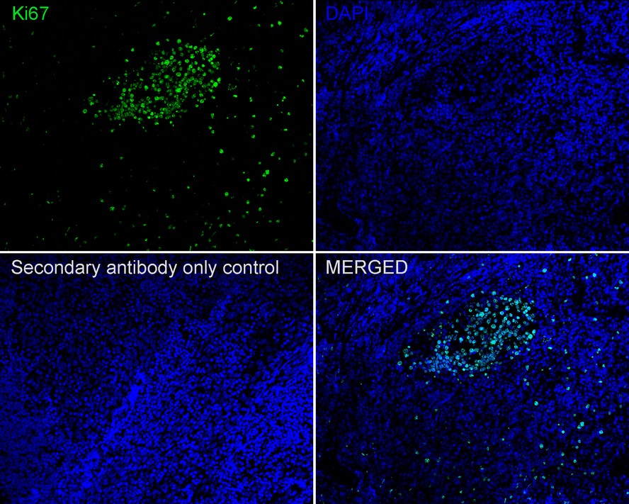 Immunohistochemical analysis of paraffin-embedded rat thymus tissue with Rabbit anti-Ki67 antibody (<a href="/products/HA721115" style="font-weight: bold;text-decoration: underline;">HA721115</a>) at 1/8,000 dilution.<br /><br />The section was pre-treated using heat mediated antigen retrieval with sodium citrate buffer (pH 6.0) for 2 minutes. The tissues were blocked in 1% BSA for 20 minutes at room temperature, washed with ddH<sub>2</sub>O and PBS, and then probed with the primary antibody (<a href="/products/HA721115" style="font-weight: bold;text-decoration: underline;">HA721115</a>) at 1/8,000 dilution for 1 hour at room temperature. The detection was performed using an HRP conjugated compact polymer system. DAB was used as the chromogen. Tissues were counterstained with hematoxylin and mounted with DPX.