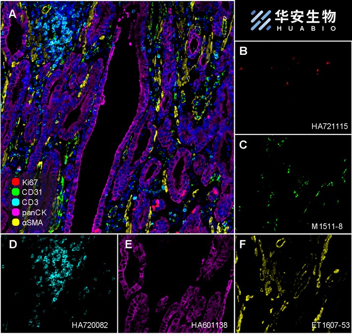 Immunofluorescence analysis of paraffin-embedded human tonsil tissue labeling Ki67 with Rabbit anti-Ki67 antibody (<a href="/products/HA721115" style="font-weight: bold;text-decoration: underline;">HA721115</a>) at 1/500 dilution.<br /><br />The section was pre-treated using heat mediated antigen retrieval with Tris-EDTA buffer (pH 9.0) for 20 minutes. The tissues were blocked in 10% negative goat serum for 1 hour at room temperature, washed with PBS, and then probed with the primary antibody (<a href="/products/HA721115" style="font-weight: bold;text-decoration: underline;">HA721115</a>, green) at 1/500 dilution overnight at 4 ℃, washed with PBS. Goat Anti-Rabbit IgG H&L (iFluor™ 488, <a href="/products/HA1121" style="font-weight: bold;text-decoration: underline;">HA1121</a>) was used as the secondary antibody at 1/1,000 dilution. Nuclei were counterstained with DAPI (blue).