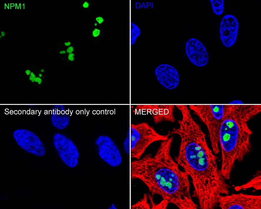 Immunohistochemical analysis of paraffin-embedded rat kidney tissue with Rabbit anti-Nucleophosmin antibody (<a href=