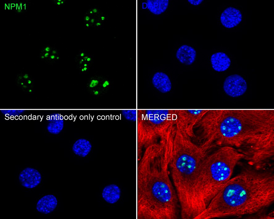 Immunohistochemical analysis of paraffin-embedded mouse small intestine tissue with Rabbit anti-Nucleophosmin antibody (<a href=