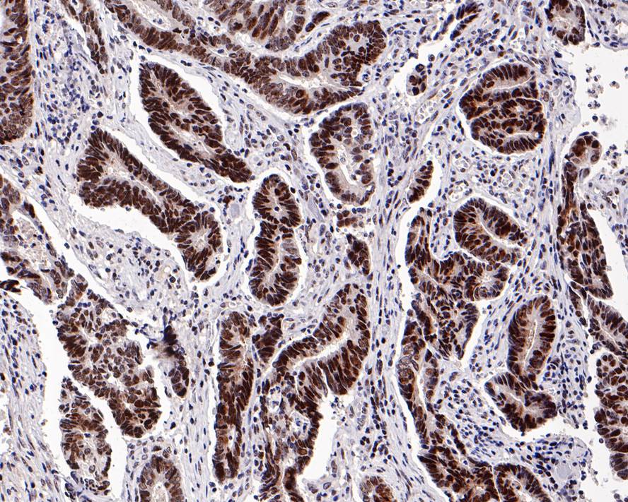 Immunohistochemical analysis of paraffin-embedded human skin tissue with Rabbit anti-Nucleophosmin antibody (<a href=