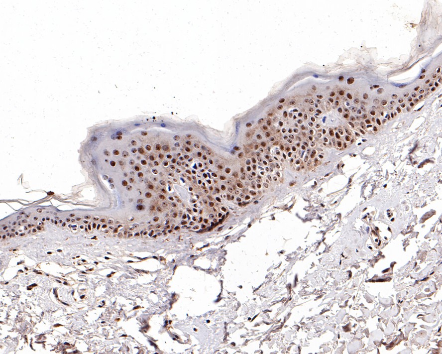 Flow cytometric analysis of Daudi cells labeling Nucleophosmin.<br /><br />Cells were fixed and permeabilized. Then stained with the primary antibody (<a href=