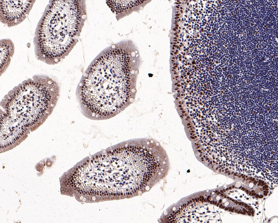 Flow cytometric analysis of HL-60 cells labeling Nucleophosmin.<br /><br />Cells were fixed and permeabilized. Then stained with the primary antibody (<a href=