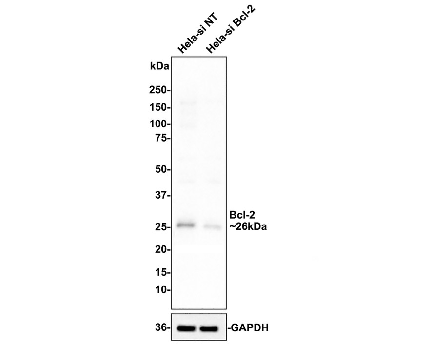 <span style="font-weight: bold;">☑ Knockdown (KD)</span><br /><br />Western blot analysis of Bcl-2 on different lysates with Rabbit anti-Bcl-2 antibody (<a href="/products/HA721235" style="font-weight: bold;text-decoration: underline;">HA721235</a>) at 1/1,000 dilution.<br /><br />Lane 1: Hela-si NT cell lysate (10 µg/Lane)<br />Lane 2: Hela-si Bcl-2 cell lysate (10 µg/Lane)<br /><br />Predicted band size: 26 kDa<br />Observed band size: 26 kDa<br /><br />Exposure time: 31 seconds;<br />ECL: merk<br /><br />4-20% SDS-PAGE gel.<br /><br /><a href="/products/HA721235" style="font-weight: bold;text-decoration: underline;">HA721235</a> was shown to specifically react with Bcl-2 in Hela-si NT cells. Weakened band was observed when Hela-si Bcl-2 sample was tested. Hela-si NT and Hela-si Bcl-2 samples were subjected to SDS-PAGE. Proteins were transferred to a PVDF membrane and blocked with 5% NFDM in TBST for 1 hour at room temperature. The primary antibody (<a href="/products/HA721235" style="font-weight: bold;text-decoration: underline;">HA721235</a>, 1/1,000) and Loading control antibody (Rabbit anti-GAPDH, <a href="/products/ET1601-4" style="font-weight: bold;text-decoration: underline;">ET1601-4</a>, 1/10,000) were used in 5% BSA at room temperature for 2 hours. Goat Anti-rabbit IgG-HRP Secondary Antibody (<a href="/products/HA1001" style="font-weight: bold;text-decoration: underline;">HA1001</a>) at 1:100,000 dilution was used for 1 hour at room temperature.