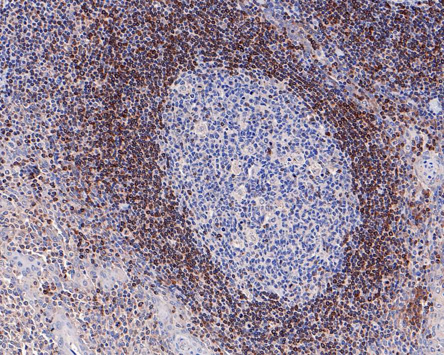 Immunohistochemical analysis of paraffin-embedded human tonsil tissue with Rabbit anti-Bcl-2 antibody (<a href="/products/HA721235" style="font-weight: bold;text-decoration: underline;">HA721235</a>) at 1/2,000 dilution.<br /><br />The section was pre-treated using heat mediated antigen retrieval with Tris-EDTA buffer (pH 9.0) for 20 minutes. The tissues were blocked in 1% BSA for 20 minutes at room temperature, washed with ddH<sub>2</sub>O and PBS, and then probed with the primary antibody (<a href="/products/HA721235" style="font-weight: bold;text-decoration: underline;">HA721235</a>) at 1/2,000 dilution for 1 hour at room temperature. The detection was performed using an HRP conjugated compact polymer system. DAB was used as the chromogen. Tissues were counterstained with hematoxylin and mounted with DPX.