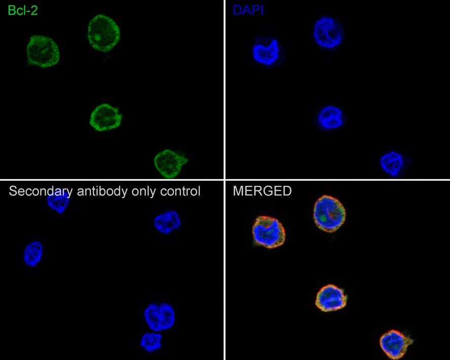Immunocytochemistry analysis of THP-1 cells labeling Bcl-2 with Rabbit anti-Bcl-2 antibody (<a href="/products/HA721235" style="font-weight: bold;text-decoration: underline;">HA721235</a>) at 1/100 dilution.<br /><br />Cells were fixed in 4% paraformaldehyde for 20 minutes at room temperature, permeabilized with 0.1% Triton X-100 in PBS for 5 minutes at room temperature, then blocked with 1% BSA in 10% negative goat serum for 1 hour at room temperature. Cells were then incubated with Rabbit anti-Bcl-2 antibody (<a href="/products/HA721235" style="font-weight: bold;text-decoration: underline;">HA721235</a>) at 1/100 dilution in 1% BSA in PBST overnight at 4 ℃. Goat Anti-Rabbit IgG H&L (iFluor™ 488, <a href="/products/HA1121" style="font-weight: bold;text-decoration: underline;">HA1121</a>) was used as the secondary antibody at 1/1,000 dilution. PBS instead of the primary antibody was used as the secondary antibody only control. Nuclear DNA was labelled in blue with DAPI.<br /><br />Beta tubulin (<a href="/products/M1305-2" style="font-weight: bold;text-decoration: underline;">M1305-2</a>, red) was stained at 1/100 dilution overnight at +4℃. Goat Anti-Mouse IgG H&L (iFluor™ 594, <a href="/products/HA1126" style="font-weight: bold;text-decoration: underline;">HA1126</a>) was used as the secondary antibody at 1/1,000 dilution.