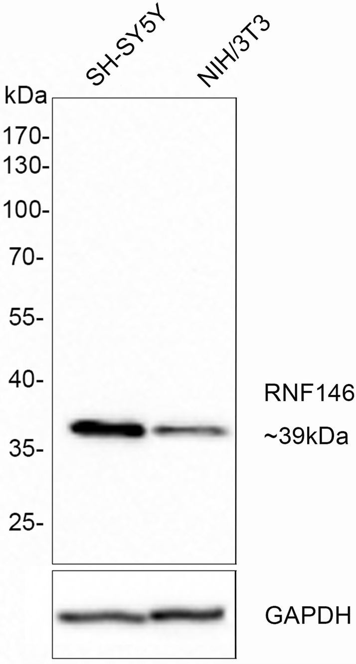 RNF146 Recombinant Rabbit monoclonal Antibody