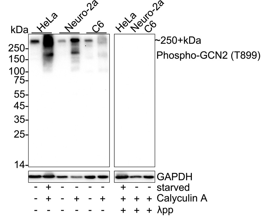 Phospho-GCN2 (T899) Recombinant Rabbit monoclonal Antibody