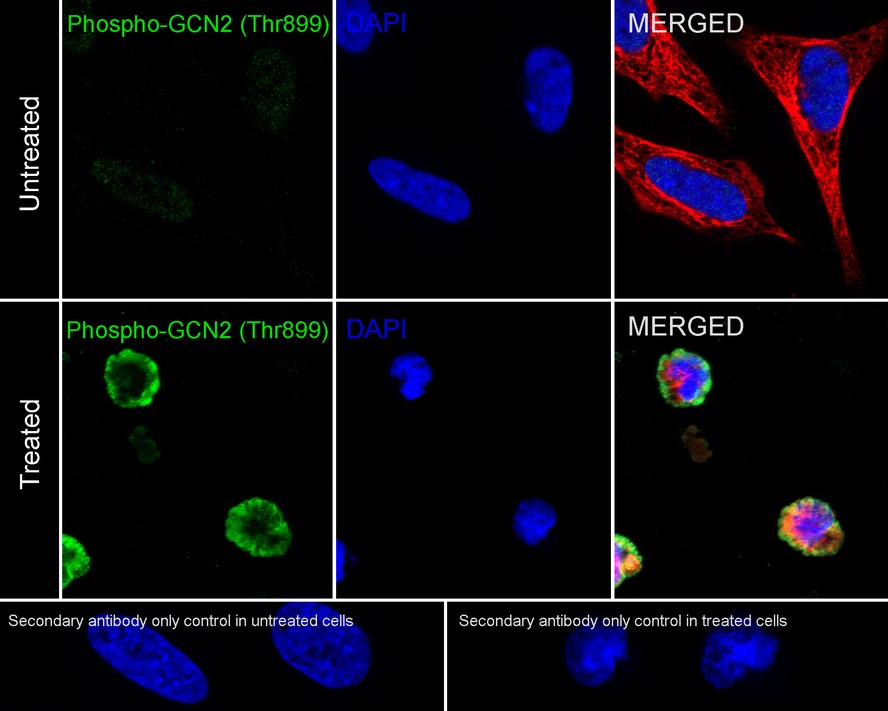 Phospho-GCN2 (T899) Recombinant Rabbit monoclonal Antibody