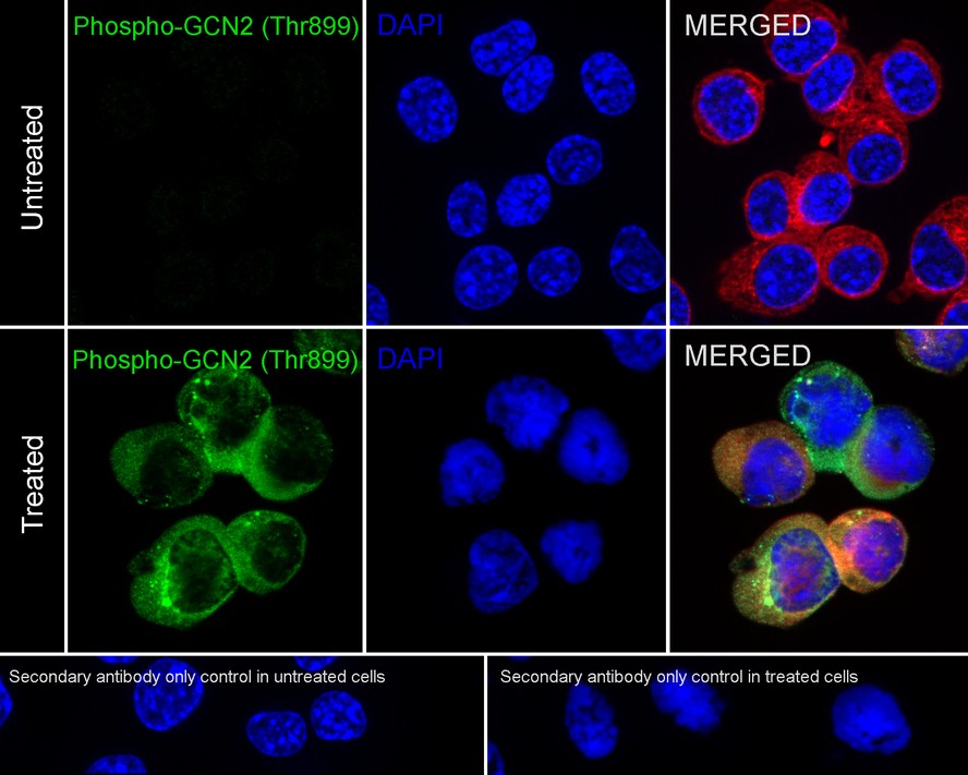 Phospho-GCN2 (T899) Recombinant Rabbit monoclonal Antibody