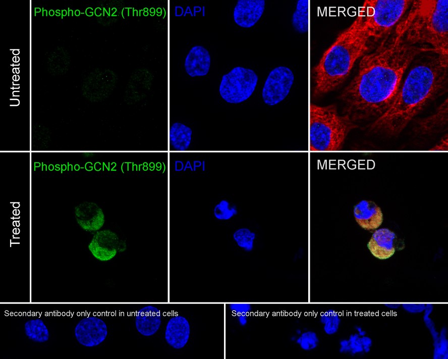 Phospho-GCN2 (T899) Recombinant Rabbit monoclonal Antibody
