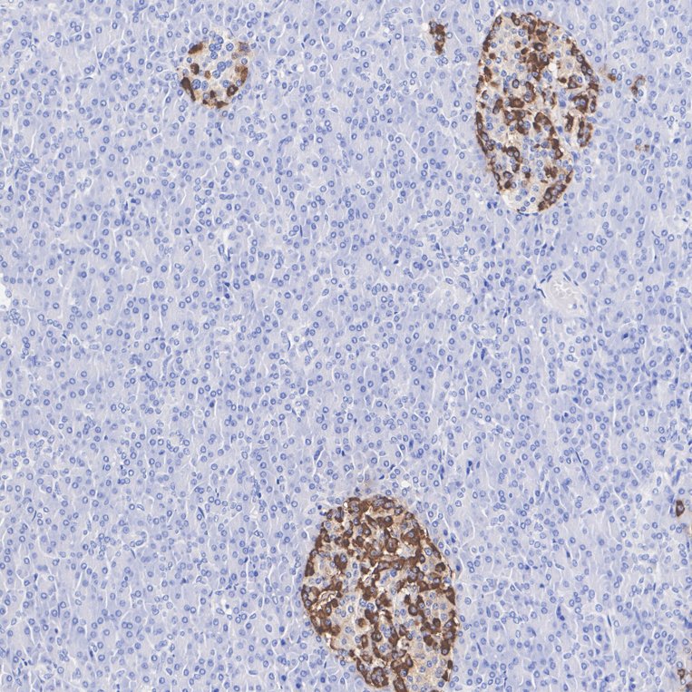 Promote the development of life sciences, high-quality monoclonal antibodies, polyclonal antibodies, proteins, and kits Promote the development of life sciences, high-quality monoclonal antibodies, polyclonal antibodies, proteins, and kits