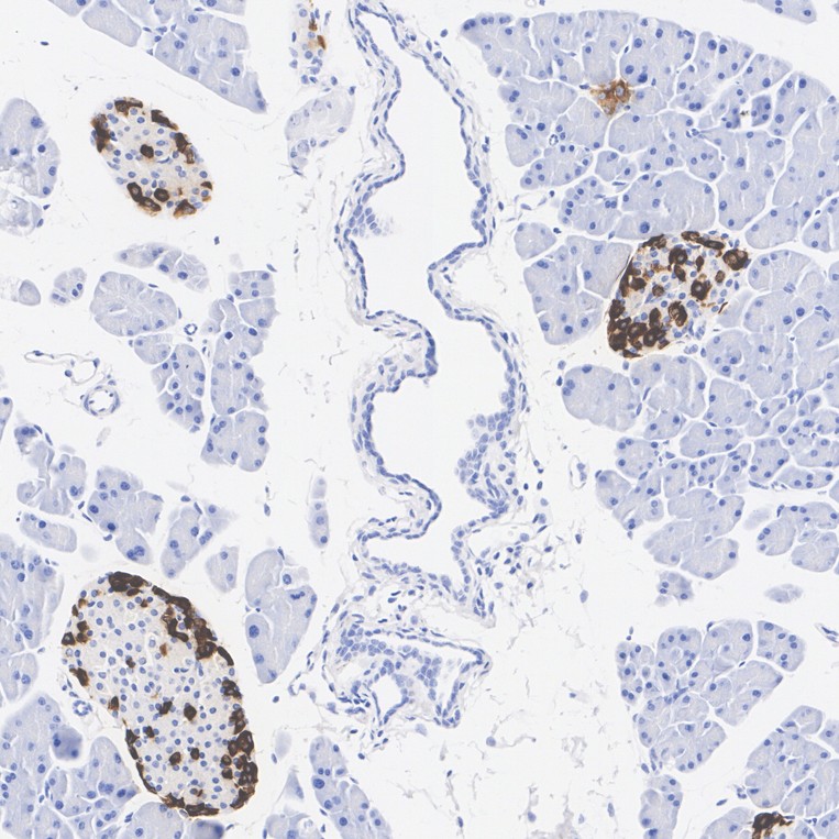 Promote the development of life sciences, high-quality monoclonal antibodies,  polyclonal antibodies, proteins, and kits