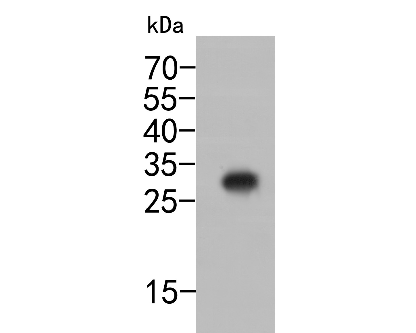 Western blot analysis of 6X His tag on C-terminal His-tagged recombinant protein lysates. Proteins were transferred to a PVDF membrane and blocked with 5% BSA in PBS for 1 hour at room temperature. The primary antibody (<a href=