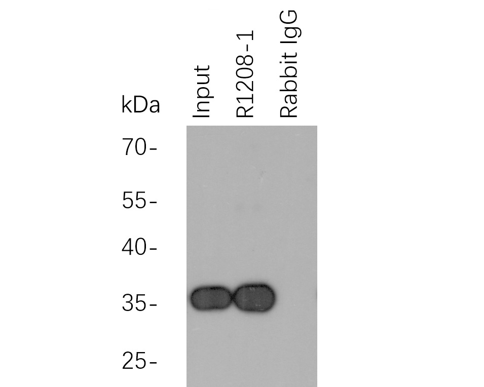 Myc tag was immunoprecipitated in 2µg C terminal Myc Tag fusion protein lysate with <a href="/products/R1208-1" style="font-weight: bold;text-decoration: underline;">R1208-1</a> at 2 µg/20 µl agarose. Western blot was performed from the immunoprecipitate using <a href="/products/EM31105" style="font-weight: bold;text-decoration: underline;">EM31105</a> at 1/1000 dilution. Anti-Mouse IgG - HRP Secondary Antibody (<a href="/products/HA1006" style="font-weight: bold;text-decoration: underline;">HA1006</a>) at 1:20,000 dilution was used for 60 mins at room temperature.<br /><br />Lane 1: Myc Tag fusion protein lysate (input).<br />Lane 2: <a href="/products/R1208-1" style="font-weight: bold;text-decoration: underline;">R1208-1</a> IP in Myc Tag fusion protein lysate.<br />Lane 3: Rabbit IgG instead of <a href="/products/R1208-1" style="font-weight: bold;text-decoration: underline;">R1208-1</a> in Myc Tag fusion protein lysate.<br /><br />Blocking/Dilution buffer: 5% NFDM/TBST