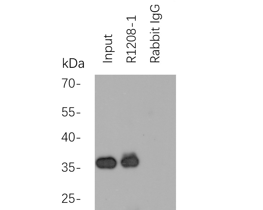 Myc tag was immunoprecipitated in 2µg N terminal Myc Tag fusion protein lysate with <a href="/products/R1208-1" style="font-weight: bold;text-decoration: underline;">R1208-1</a> at 2 µg/20 µl agarose. Western blot was performed from the immunoprecipitate using <a href="/products/EM31105" style="font-weight: bold;text-decoration: underline;">EM31105</a> at 1/1000 dilution. Anti-Mouse IgG - HRP Secondary Antibody (<a href="/products/HA1006" style="font-weight: bold;text-decoration: underline;">HA1006</a>) at 1:20,000 dilution was used for 60 mins at room temperature.<br /><br />Lane 1: Myc Tag fusion protein lysate (input).<br />Lane 2: <a href="/products/R1208-1" style="font-weight: bold;text-decoration: underline;">R1208-1</a> IP in Myc Tag fusion protein lysate.<br />Lane 3: Rabbit IgG instead of <a href="/products/R1208-1" style="font-weight: bold;text-decoration: underline;">R1208-1</a> in Myc Tag fusion protein lysate.<br /><br />Blocking/Dilution buffer: 5% NFDM/TBST