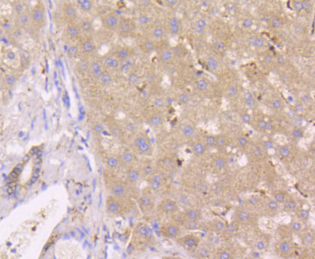 Glutathione Peroxidase 1 Rabbit Polyclonal Antibody